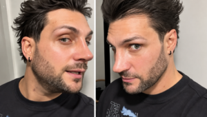 Nicola Porcella aclara rumores sobre fotos de su rinoplastia y muestra su rostro